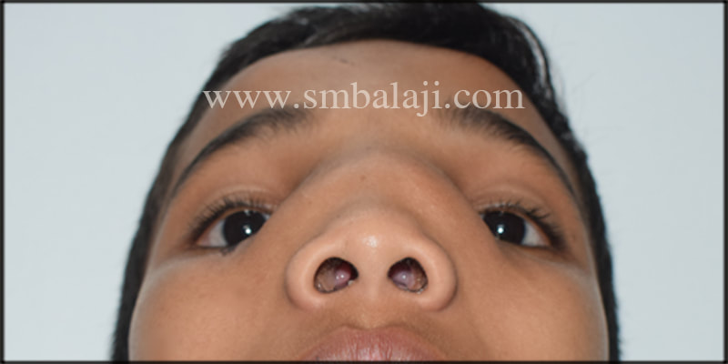 Maxillofacial Surgery India